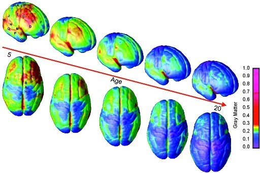 A picture of the development of a human brain.