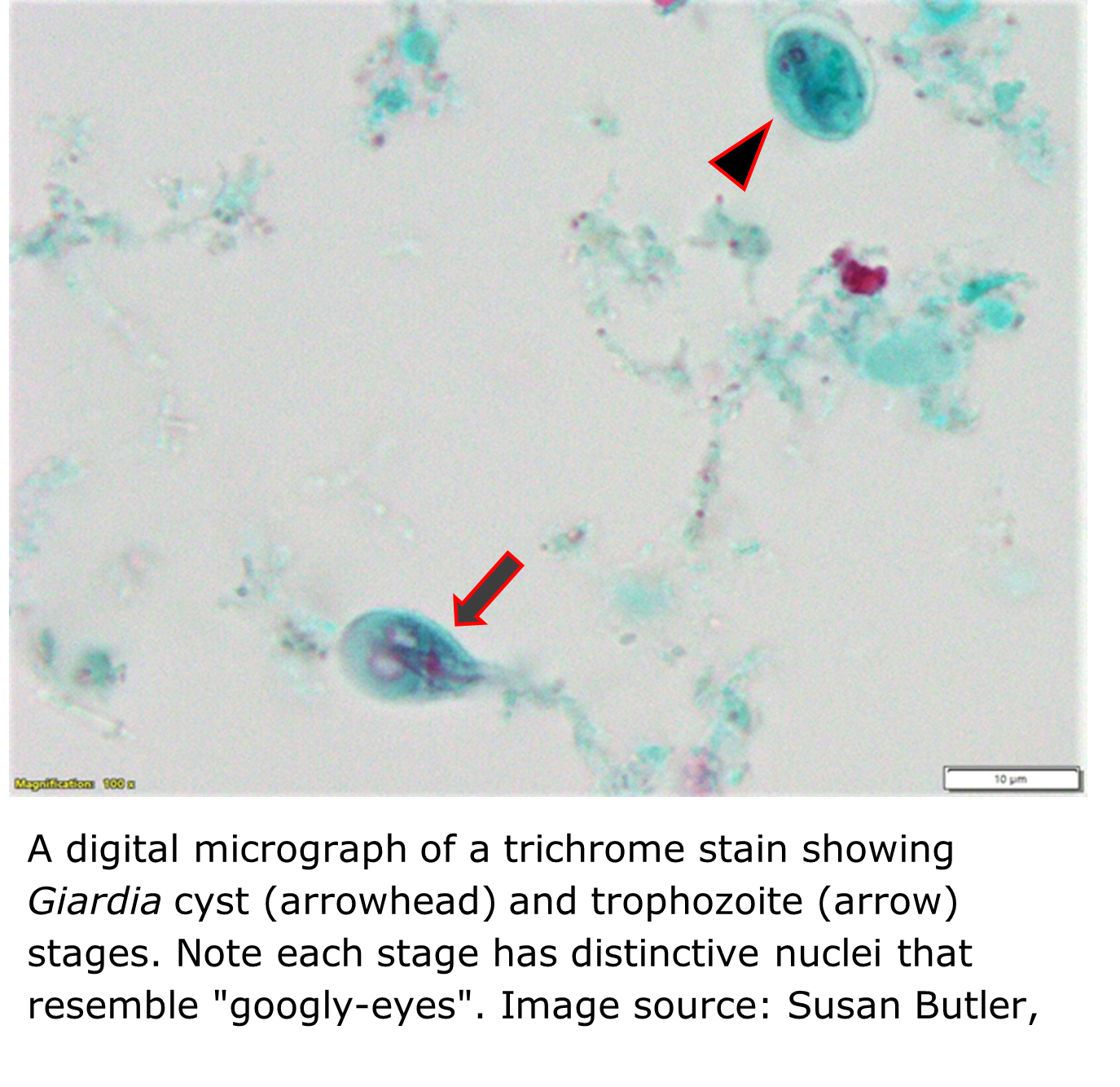 A micrograph of a trichrome stain showing green-stained tissues