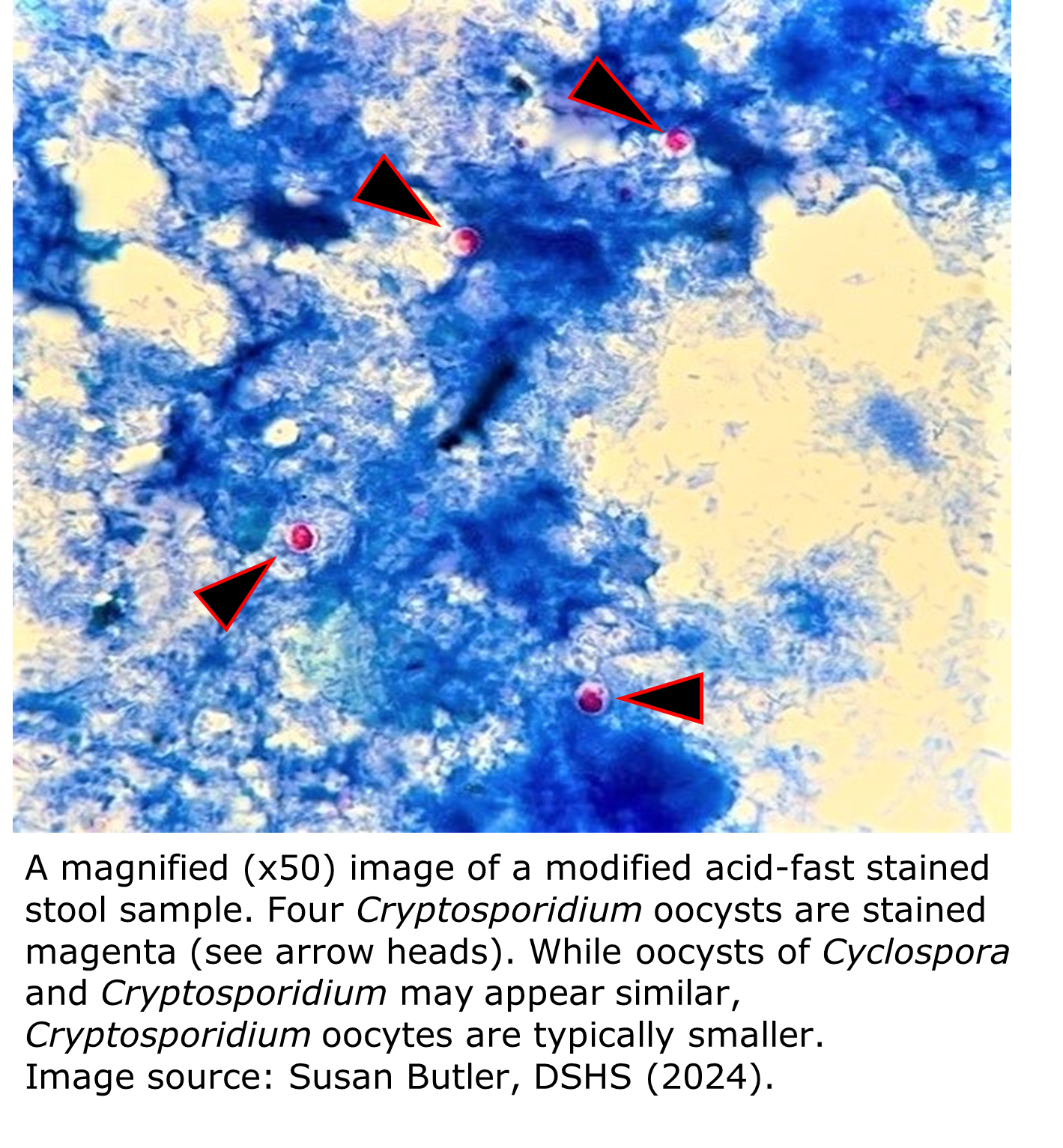 A micrograph of an acid-fast stained stool sample